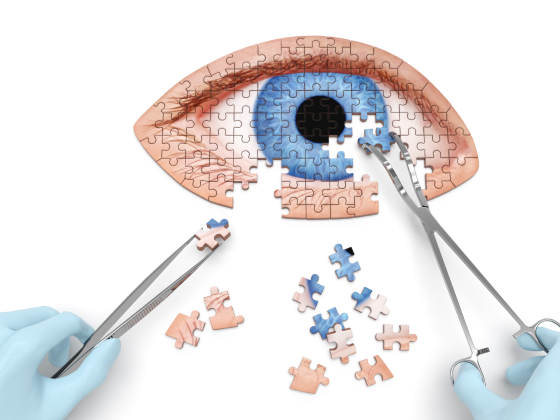 anterior-reconstruction